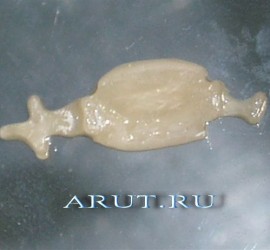 Адгезивный мостовидный протез