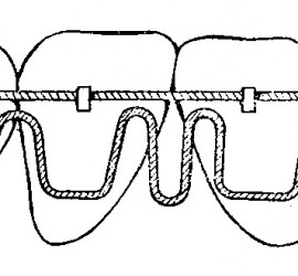 Аппарат Бегга