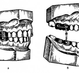 Аппарат Петросова
