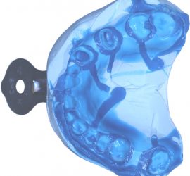 Двухслойный оттиск для изготовления МК мостовидного протеза