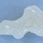 Керамическая вкладка