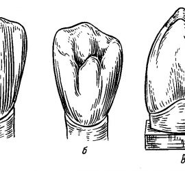 Клык нижней челюсти