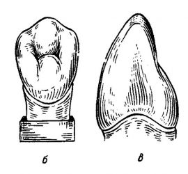 Клык верхней челюсти