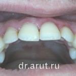 Неделю спустя после лечения