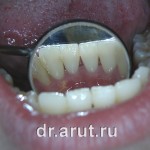 Неделю спустя после лечения