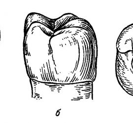 Первый моляр нижней челюсти