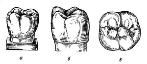 Первый моляр нижней челюсти