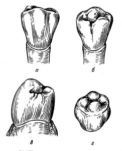 Первый премоляр нижней челюсти