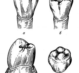 Первый премоляр нижней челюсти