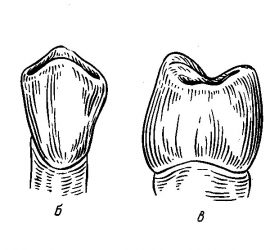 Первый премоляр верхней челюсти