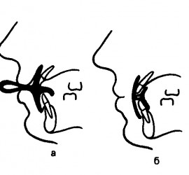 А. Вестибулярная пластинка Крауса Б. Вестибулооральная пластинка Крауса