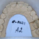 Разборная модель с керамической вкладкой