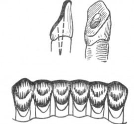 Шина Мамлока