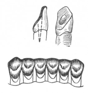 Шина Мамлока
