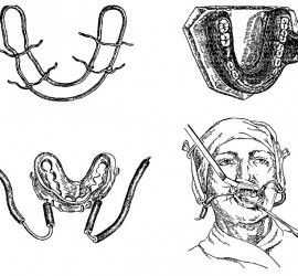 Шина Вебера