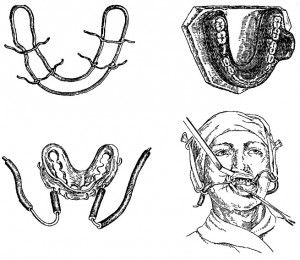 Шина Вебера