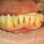 До шинирования