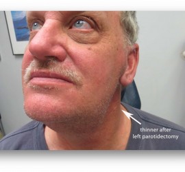 Сиаладенозы