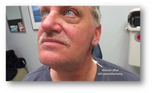 Сиаладенозы