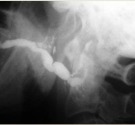 Сиалодохит