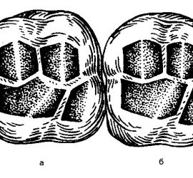 Второй моляр верхней челюсти
