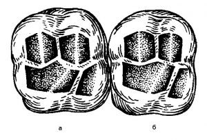 Второй моляр верхней челюсти