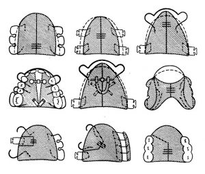 Съемные расширяющие пластинки с винтом.