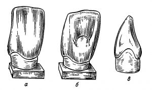 Центральные резцы нижней челюсти