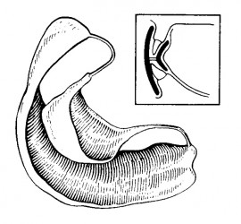 Стандартная вестибулярная пластинка Шонхера.