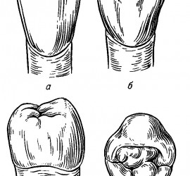 Второй премоляр нижней челюсти