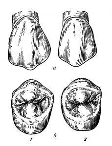 Второй премоляр верхней челюсти