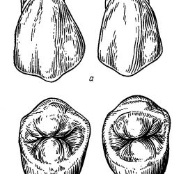 Второй премоляр верхней челюсти
