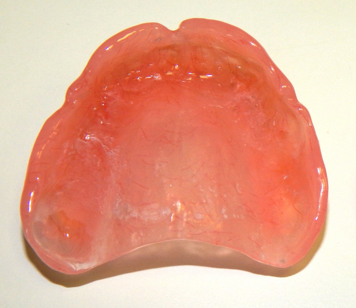 Базис протеза — Стоматология