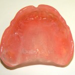 Базис протеза