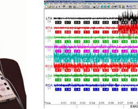 Электромиография