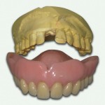 Иммедиат-протез