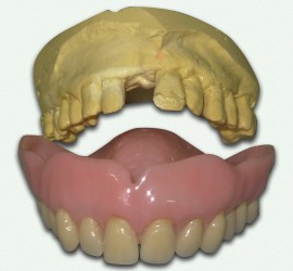 Иммедиат-протез