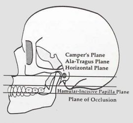 Кампера плоскость