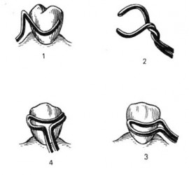 Кламмер удерживающий