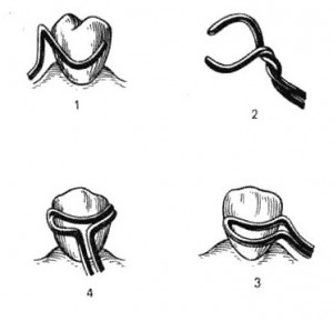 Кламмер удерживающий