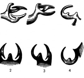 Кламмеры системы Нея