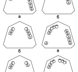 Классификация дефекта зубных рядов по Бетельману