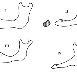 Классификация нижних беззубых челюстей Келлера