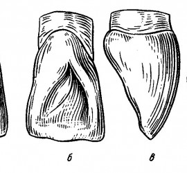 Резцы верхней челюсти.