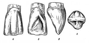 Резцы верхней челюсти.