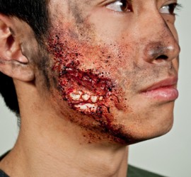 Раны и ранения челюстно-лицевой области