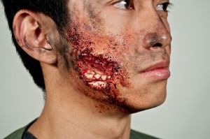 Раны и ранения челюстно-лицевой области