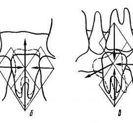 Схема артикуляционного равновесия Годона