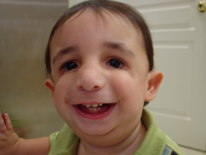 Врожденные черепно-лицевые деформации