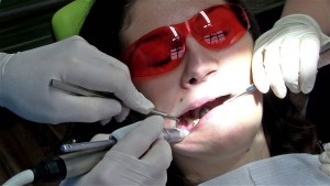 Anesto - внутрикостная анестезия